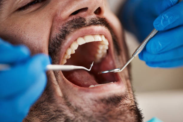 Best Laser Dentistry  in Lyman, MS